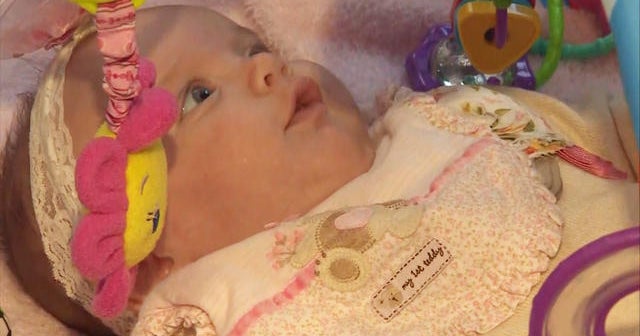 The baby girl who was born twice