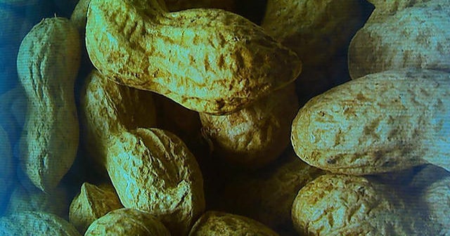 New guidelines to prevent peanut allergies