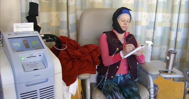 Scalp cooling therapy used to minimize hair loss from chemo