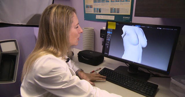 Why some women are ditching breast implants