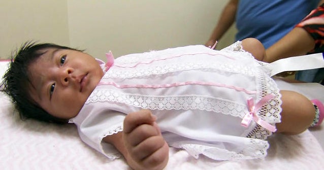 Children of Zika-positive moms closely monitored after birth