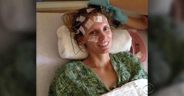 Study shows strokes are down among men, but not women