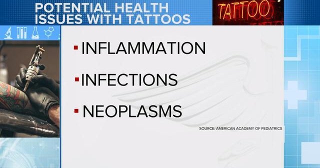 Morning Rounds: New tattoo guidelines, over-treating patients
