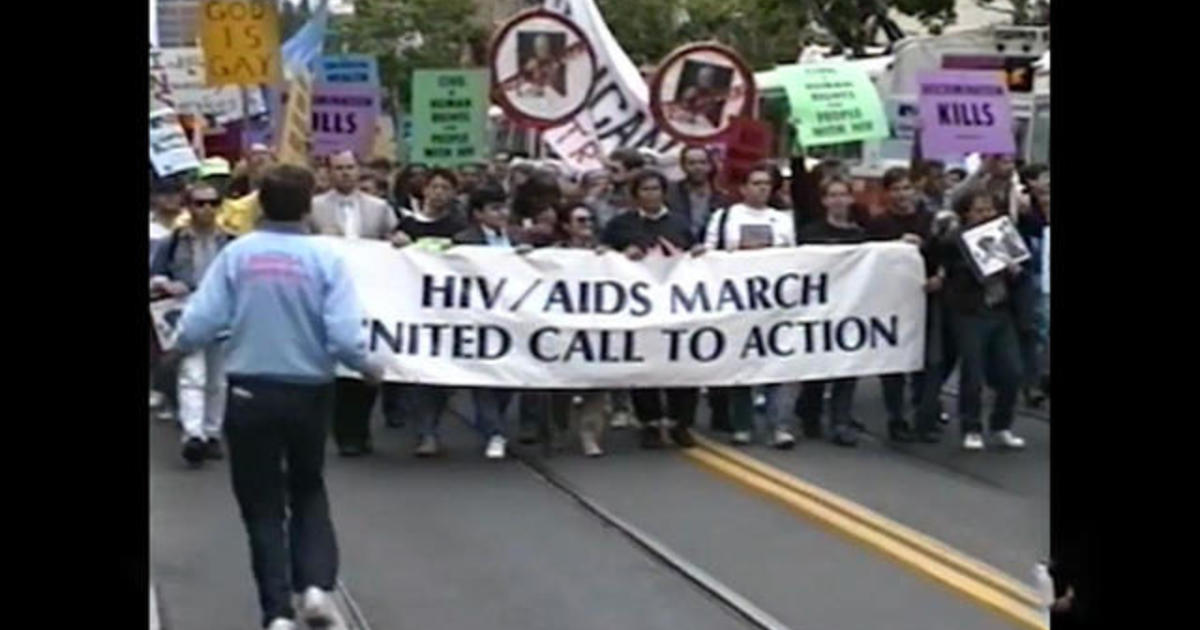 Reflecting on the AIDS epidemic, 40 years after the first reported cases in the U.S.