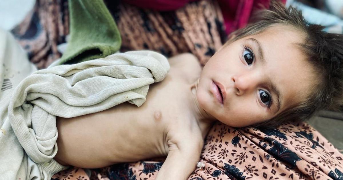 Taliban blames U.S. as 1 million Afghan kids face death by starvation - CBS  News