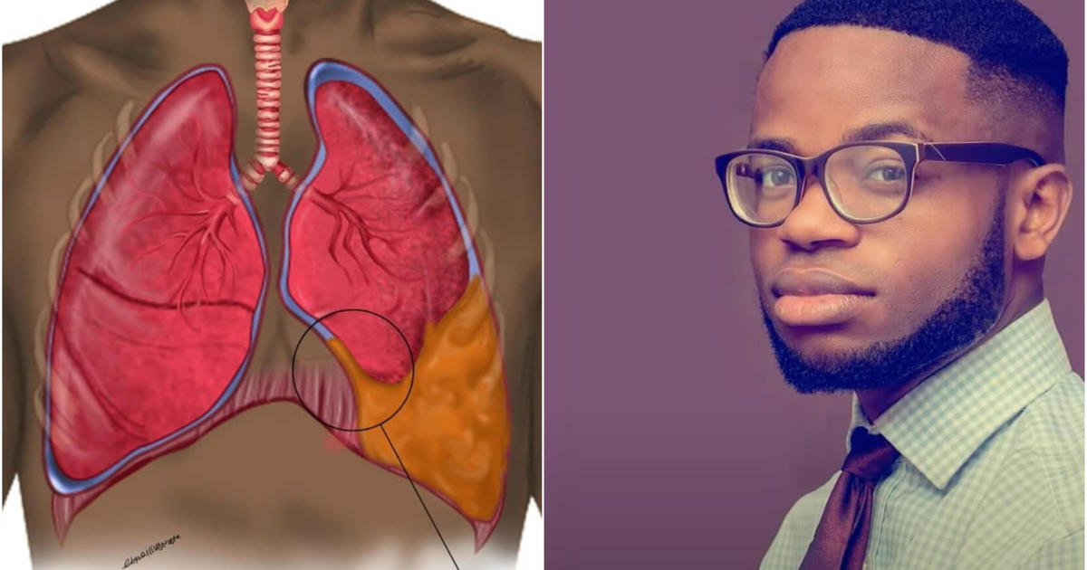 A medical illustrator noticed patients are always depicted as White. So, he decided to draw diverse medical diagrams.