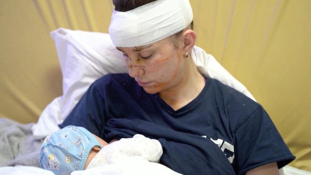 27-річна українка Ольга, яка важко поранена, укриваючи свою дитину від осколкових вибухів під час вторгнення Росії в Україну, тримає на руках свою дитину Вікторію в Києві.
