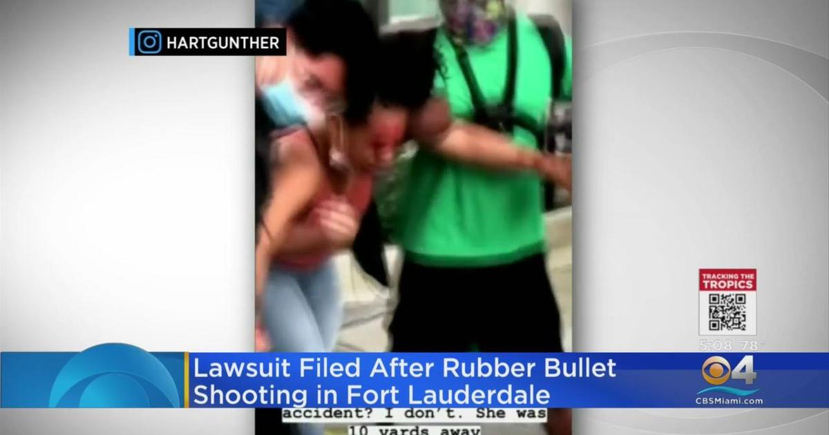 LaToya Ratlieff, who was shot with a rubber bullet during a BLM protest, suing Fort Lauderdale Polic