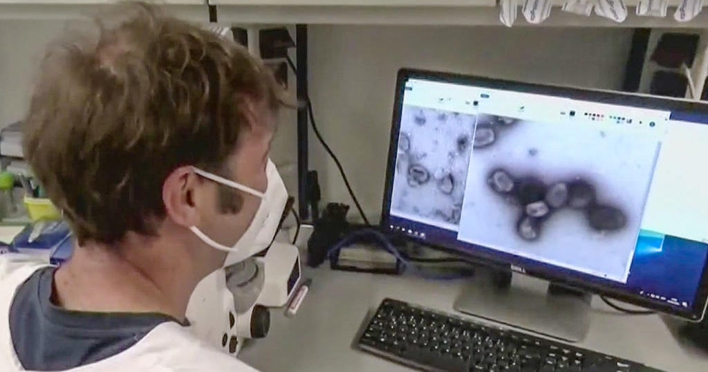 Health officials wary but not alarmed by monkeypox in Bay Area - Vimarsana News